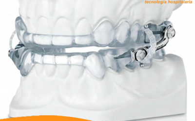 Aparatos bucales como tratamiento de apnea obstructiva del sueño (AOS)