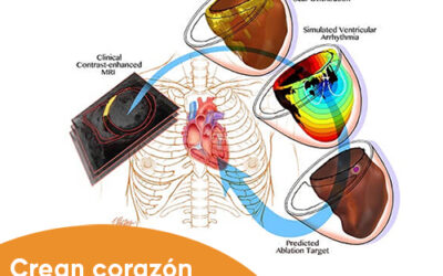 Crean copia virtual de corazón para tratar la taquicardia ventricular