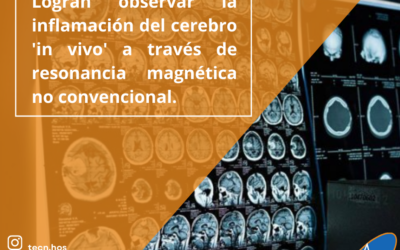 Logran observar la inflamación del cerebro  ‘in vivo’ a través de resonancia magnética no convencional.